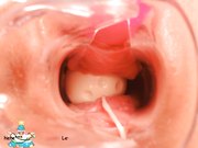 稀缺资源阴道内放置跳蛋高清近景内窥镜看阴道内部变化白浆往外流