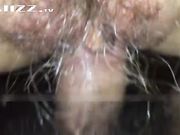 和妹妹一起生活了十八年 直到今天才知道妹妹肚子上有个疤